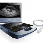PORTABLE ECHOCARDIOGRAPHY (ECHO)
